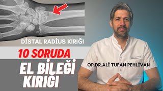 El Bileği Kırığı Nedir// El Bileği Kırığı Nasıl Tedavi Edilir? Resimi