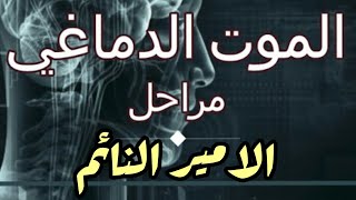 قصة الأمير النائم.. ومرض الموت الدماغي المتسبب في غيبوبته لمدة 16 عاماً