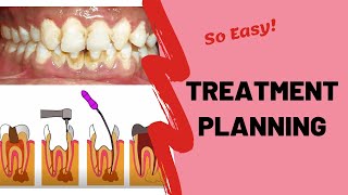 Treatment Planning | PERIODONTOLOGY