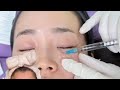 PDRN Serum, Toner &amp; Maske von Cosrx im Test