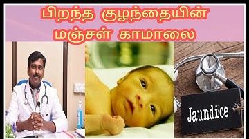 பிறந்த குழந்தைக்கு மஞ்சள் காமாலை வந்தால் என்ன செய்யனும்?| Newborn jaundice | Tamil | Dr Sudhakar |