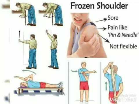 Frozen shoulder гимнастика. Frozen shoulder гимнастика. Frozen shoulder. Shoulder freeze. Frozen shoulder.