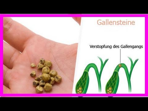 Video: 7 Hausmittel Gegen Gallensteinerkrankungen