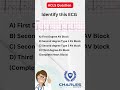 Master ACLS ECG Interpretation with Sample Questions 🩺