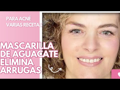 Mascarillas de aguacate 🥑 para combatir arrugas , manchas , acne