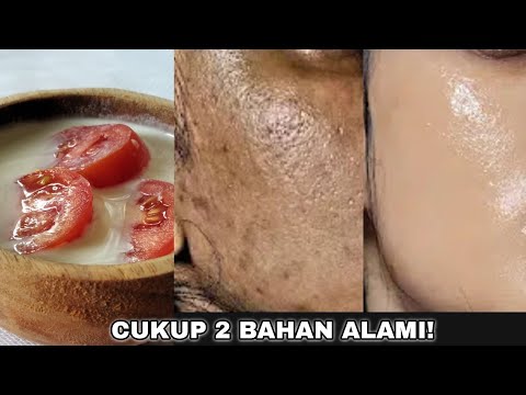 Kulit Kasar Di Muka