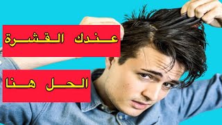 الحل السحري والنهائي للقشرة #shorts