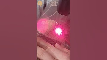 이레즈미 대형문신제거 #shorts