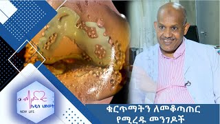 ቁርጥማትን ለመቆጣጠር የሚረዱ መንገዶች /NEW LIFE