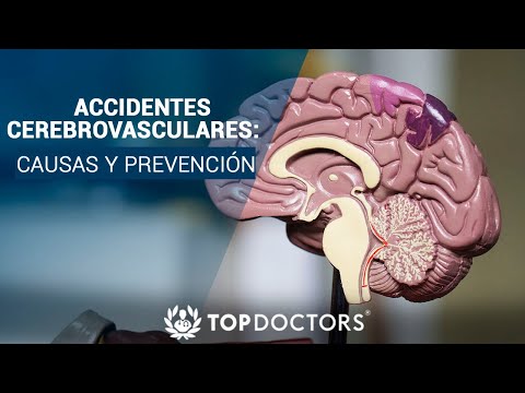 Accidentes Cerebrovasculares en jóvenes: causas y prevención