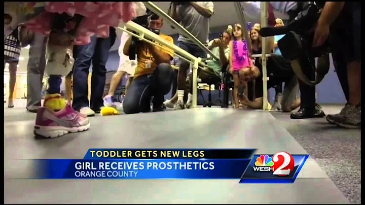 2-year-old who lost legs walks again