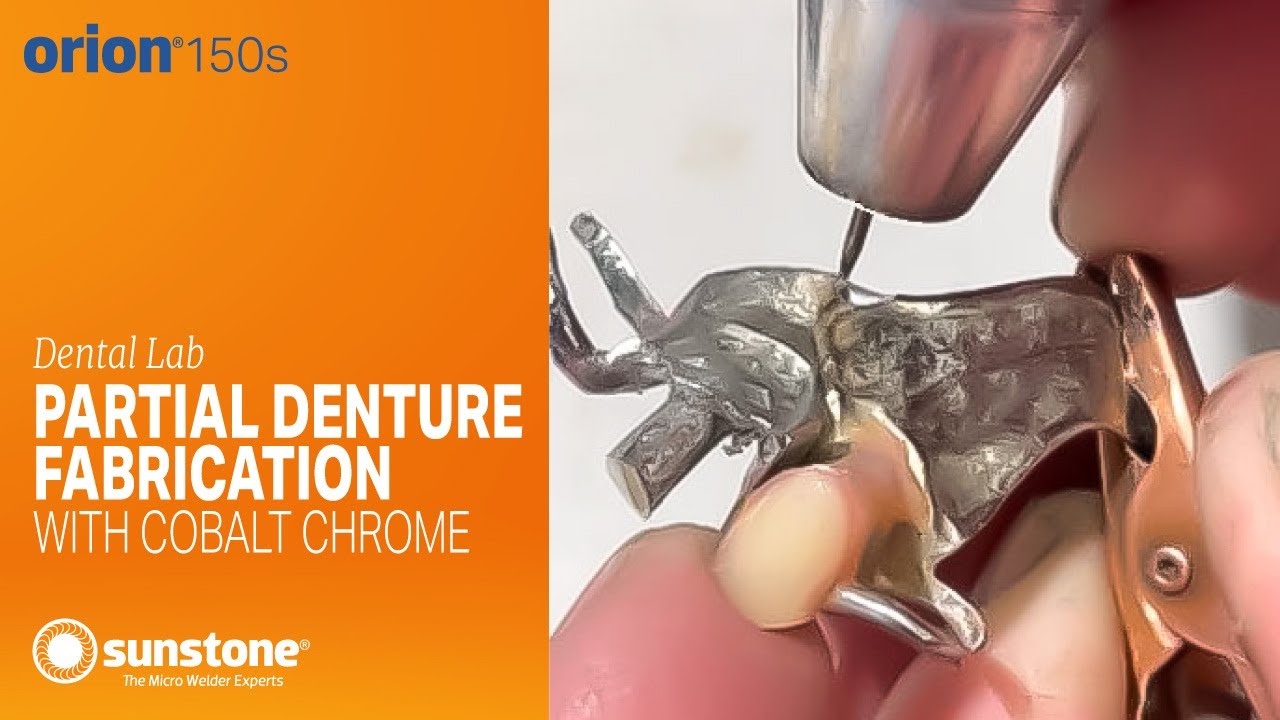 Partial Denture Fabrication with Cobalt Chrome and the Orion 150s Pulse Arc Welder