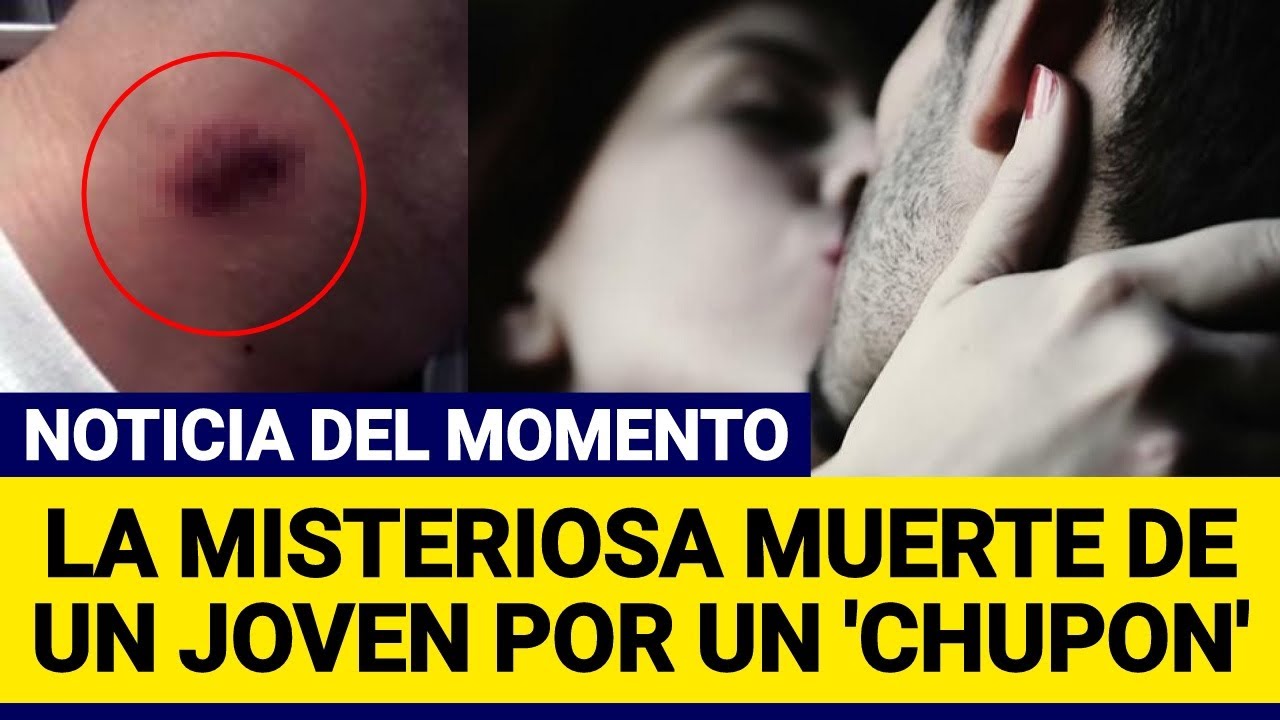 La muerte de un joven por un chupón en el cuello da la vuelta al mundo ...