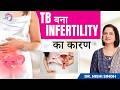 क्या TB आपकी INFERTILITY का कारण हो सकती है? Genital Tuberculosis (TB) के लक्षण और इलाज | Prime IVF
