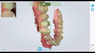 Scanning full arch   Seikowave scanner 2021 03 29 14 44 49