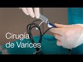 Operación de varices: ¿qué riesgos tiene? ¿Cómo es el postoperatorio?