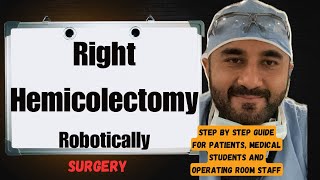 Famous What to Expect for Right Hemicolectomy Robotically Surgery 😳(Step by step guide) must 👀 Net Worth