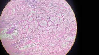 Dense connective tissue (Slide Lab. Connective Tissue)