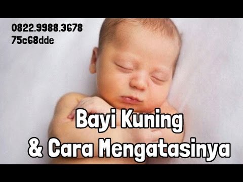 Cara Mengatasi Bayi Kuning 0822-9988-3678 bbm 75c68dde