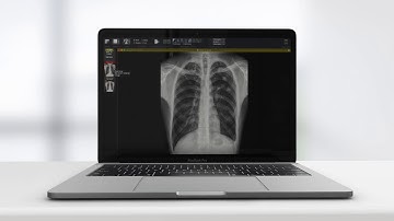 1QBit Presents XrAI, an AI-Powered Clinical Decision Support Tool for X-Ray Interpretation
