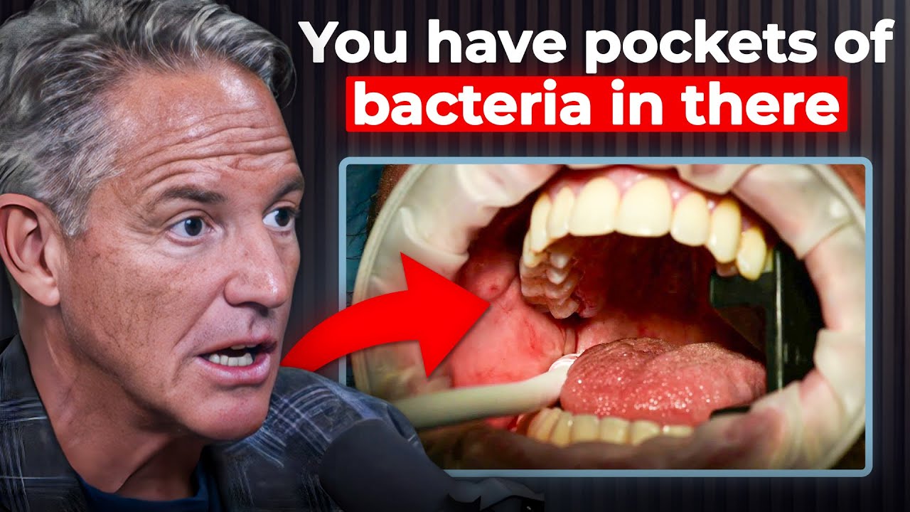 The Hidden Infection in Your Mouth That Can Lead To Memory Loss - YouTube