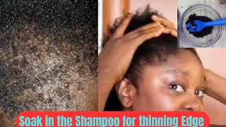Soak this ingredients in your shampoo, it will accelerate your hair growth and treat baldness