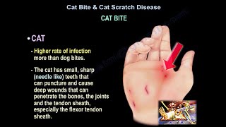 Cat Bite & Cat Scratch Disease - Everything You Need To Know - Dr. Nabil  Ebraheim - YouTube