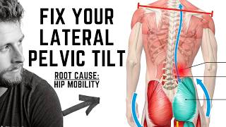 Struggling With Lateral Pelvic Tilt Do THIS for Balance