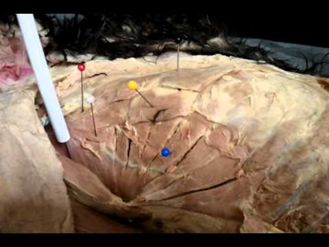 Anat 10a cat dissection 7 - YouTube