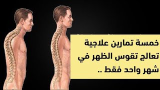 علاج تقوس الظهر(الأتب)kyphosis في شهر واحد فقط|دكتور خلدون الحوراني