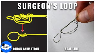 Surgeon's Loop | Animation & Actual Line