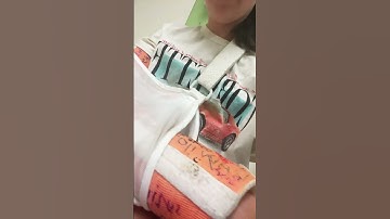 NEW CASTTT!!!🥳 #trend #brokenarm