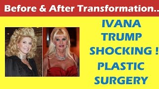 Ivana Trump Plastic Surgery Before and After Full HD