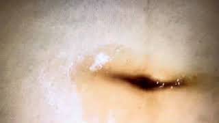 Navel Play Continues