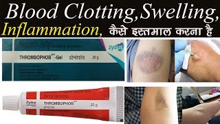 Thrombophob Ointmentgel Benzyl Nicotinate Heparin Superficial Thrombophlebitis Blood Clot