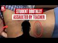 Bengaluru: Class 4 Student Brutally Assaulted By Teacher For Not Doing Homework, FIR Filed