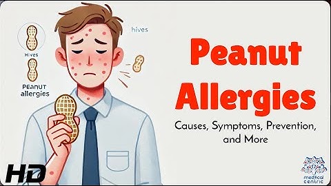 Peanut Allergy 101: Causes, Symptoms, and Prevention!