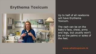 Erythema Toxi Full Version F1 Dec 6