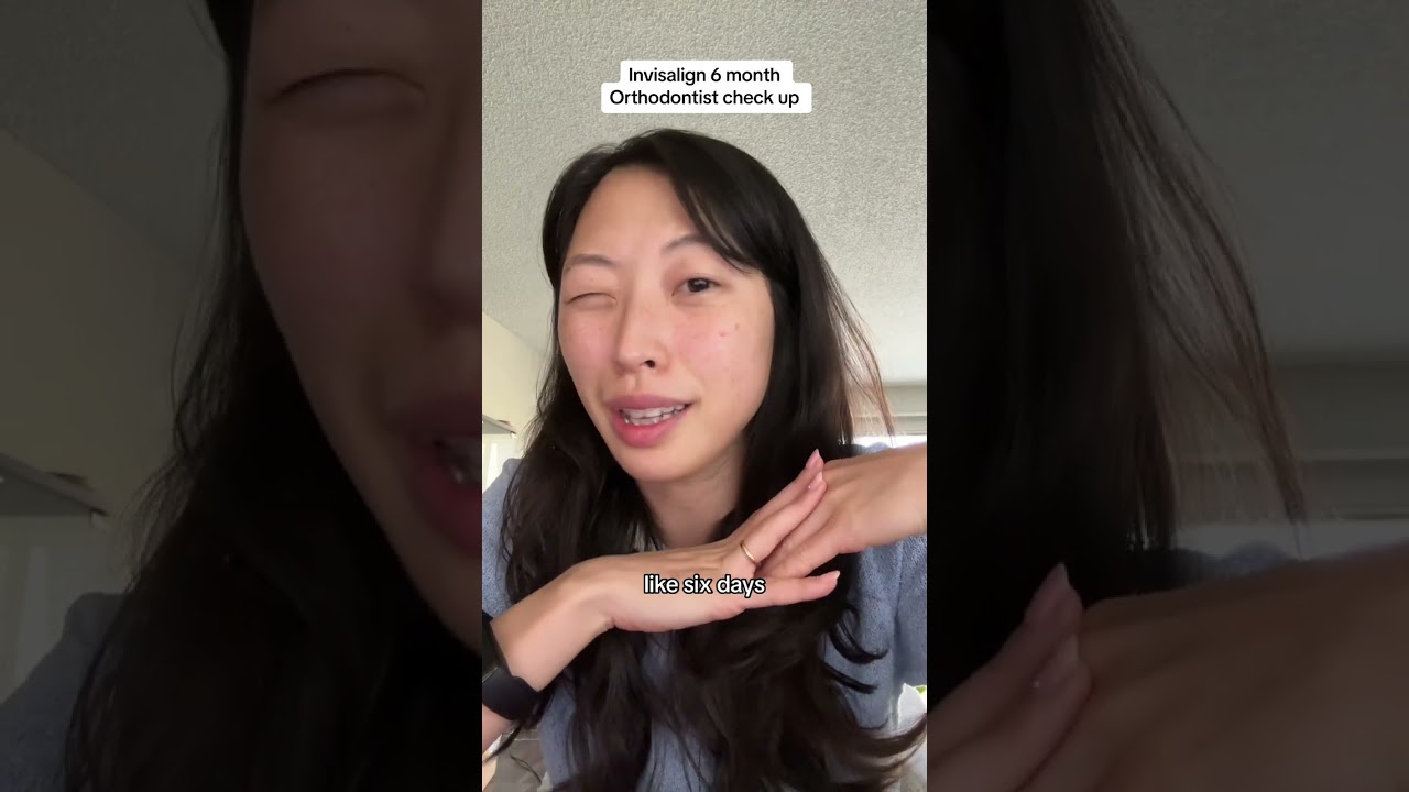 Invisalign: 8th Month Update | X-rays, IPR, teeth not tracking