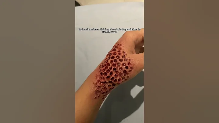 TRIGGER WARNING : TRYPOPHOBIA ⚠️