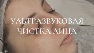 Ультразвуковая чистка лица