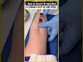 IV cannulation #usa #reels #youtubeshorts #trending #viral #trendingshorts #ivcannula #nursing