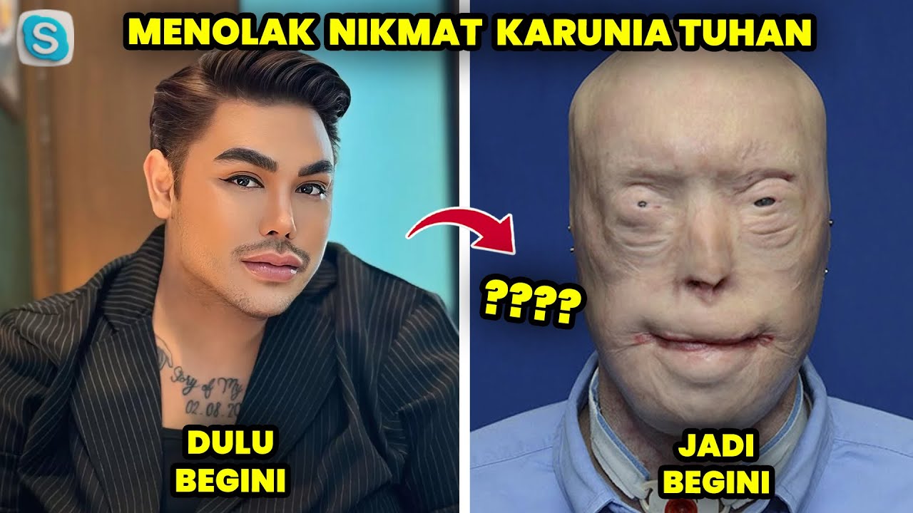 MENYESAL SELAMANYYA! Begini 10 Kondisi Wajah Artis Indonesia yang Gagal Operasi Plastik
