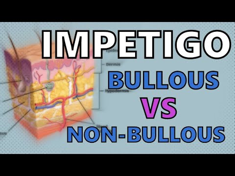 IMPETIGO EXPLAINED IN 2 MINUTES - BULLOUS vs NON-BULLOUS IMPETIGO