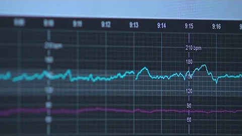 New tech gives moms extra safety during labor