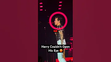 Harry Styles Got HURT By A Fan!