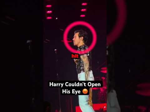 Harry Styles Got Hurt By A Fan!