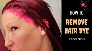 HOW TO REMOVE HAIR DYE STAIN FROM SKIN INSTANTLY// Fastest way to get hair dye off skin!