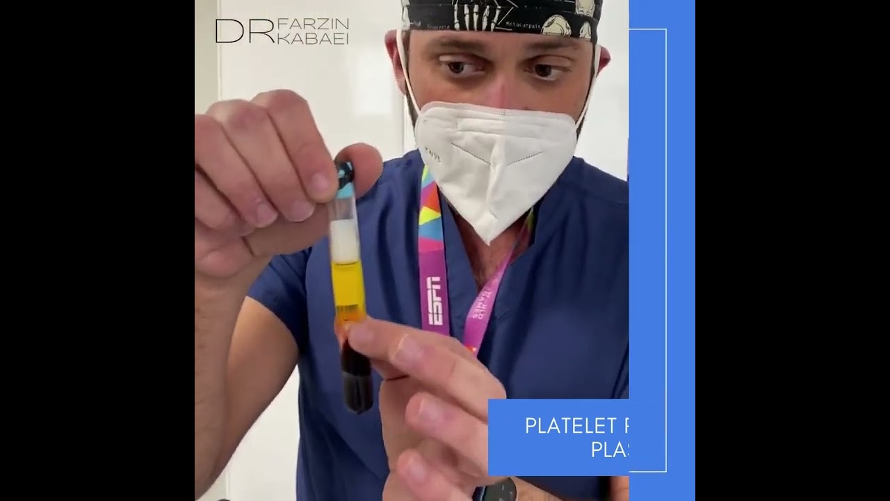 Los Angeles Platelet Rich Plasma (PRP) Injections | West Hollywood | Dr. Farzin Kabaei Orthopedics
