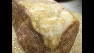 New Human Organ Discovery Validates Mudfossil Research